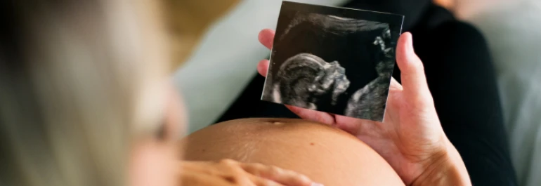 ¿Cómo se calcula la bonificación de maternidad de la cuota de autónomos de seguridad social?