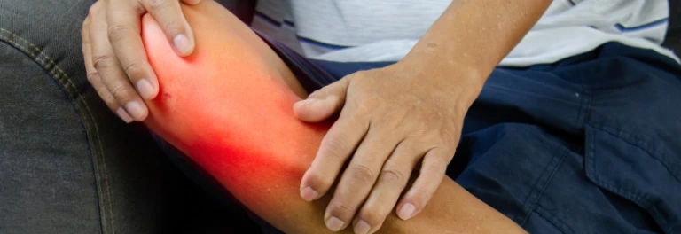  Rodilla lesionada brillando por lesión. mientras hombre se la sujeta 